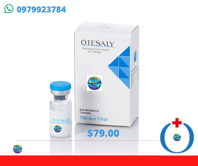 otesaly-940x 788.png