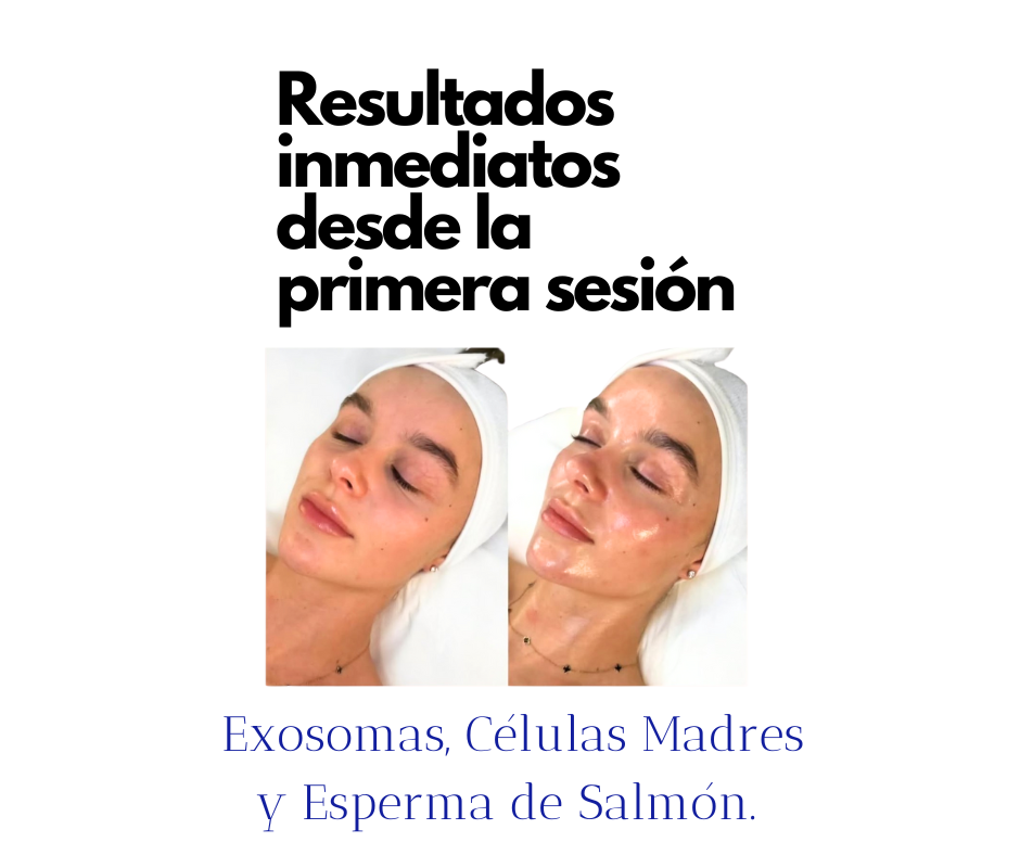 curso exosomas bioestimulacion de colageno esperma de salmon lima peru
